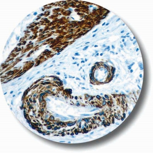 IHC of Caldesmon on an FFPE Appendix Tissue